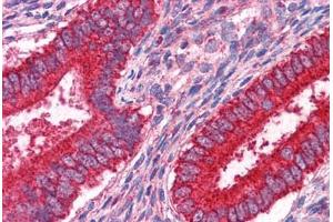 Human Uterus: Formalin-Fixed, Paraffin-Embedded (FFPE) (JUP antibody  (AA 1-746))