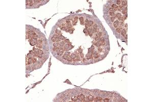 Immunohistochemistry of paraffin-embedded rat testis using NCK11 Rabbit mAb (ABIN7268834) at dilution of 1:100 (40x lens). (NCK1 antibody)