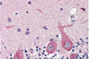ABIN334405 (4µg/ml) staining of paraffin embedded Human Cerebellum. (GAD antibody  (Internal Region))