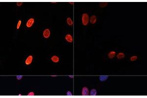 Immunofluorescence analysis of NIH/3T3 cells using Acetyl-Histone H3-K56 Polyclonal Antibody at dilution of 1:100.