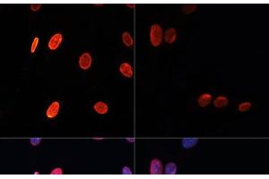 Immunofluorescence analysis of NIH/3T3 cells using Acetyl-Histone H3-K56 Polyclonal Antibody at dilution of 1:100. (Histone 3 antibody  (acLys56))