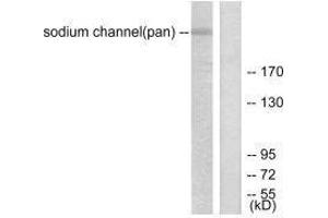 Western blot analysis of extracts from HuvEc cells, using Sodium Channel-pan antibody. (SCN5A antibody)