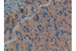DAB staining on IHC-P; Samples: Mouse Stomach Tissue (PKC delta antibody  (AA 328-674))