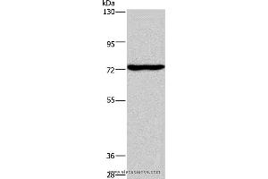 Western blot analysis of Mouse brain tissue, using KCND1 Polyclonal Antibody at dilution of 1:400