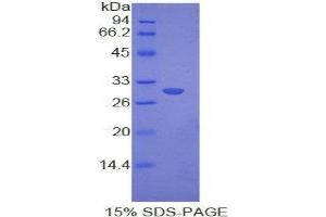 SDS-PAGE (SDS) image for Myosin IE (MYO1E) (AA 772-1033) protein (His tag) (ABIN1878000) (MYO1E Protein (AA 772-1033) (His tag))