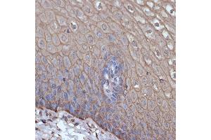 Immunohistochemistry of paraffin-embedded human esophageal using TMPRSS2 Rabbit mAb (ABIN7270946) at dilution of 1:100 (40x lens). (TMPRSS2 antibody)