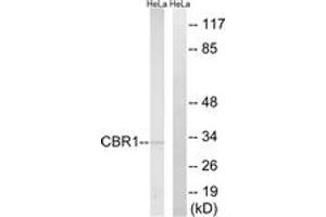 Western blot analysis of extracts from HeLa cells, using CBR1 Antibody. (CBR1 antibody  (AA 181-230))