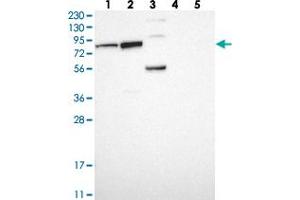 Western blot analysis of Lane 1: RT-4, Lane 2: U-251 MG, Lane 3: Human Plasma, Lane 4: Liver, Lane 5: Tonsil with PUS7 polyclonal antibody  at 1:250-1:500 dilution. (PUS7 antibody)