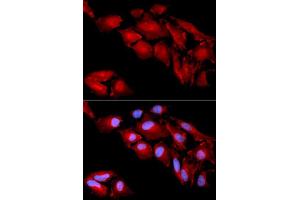 Immunofluorescence analysis of U2OS cells using CTNND1 antibody (ABIN5970810). (CTNND1 antibody)