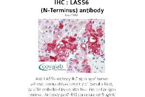 Image no. 1 for anti-Ceramide Synthase 6 (CERS6) (N-Term) antibody (ABIN1736367) (CERS6 antibody  (N-Term))