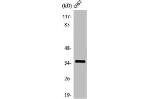 Western Blot analysis of LOVO cells using Olfactory receptor 10S1 Polyclonal Antibody (OR1S1 antibody  (Internal Region))