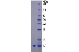 SDS-PAGE of Protein Standard from the Kit (Highly purified E. (Insulin ELISA Kit)