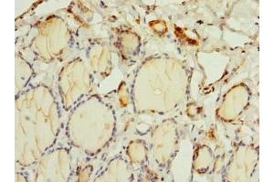 Immunohistochemistry of paraffin-embedded human thyroid tissue using ABIN7162370 at dilution of 1:100 (OSGIN2 antibody  (AA 1-250))