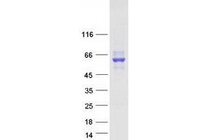 Validation with Western Blot (CES2 Protein (Transcript Variant 2) (Myc-DYKDDDDK Tag))