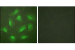 Immunofluorescence analysis of HeLa cells, treated with Forskolin (40nM, 30mins), using JAB1 antibody (ABIN5976433). (COPS5 antibody  (Internal Region))