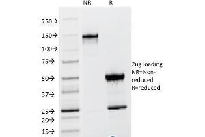 SDS-PAGE Analysis Purified TSH beta Mouse Monoclonal Antibody (TSHb/1317). (TSHB antibody)