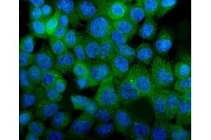 IF analysis of ITGA8 using anti-ITGA8 antibody (ABIN7601411). (ITGA8 antibody  (AA 347-964))