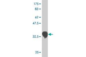 Western Blot detection against Immunogen (36. (CSRP3 antibody  (AA 95-194))