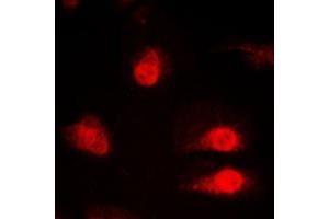 Immunofluorescent analysis of hnRNP Q staining in HeLa cells. (SYNCRIP antibody  (Center))