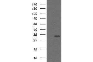 Image no. 1 for anti-Proteasome (Prosome, Macropain) Inhibitor Subunit 1 (PI31) (PSMF1) antibody (ABIN1500490) (PSMF1 antibody)