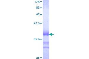 SOX12 Protein (AA 252-313) (GST tag)