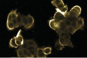 Immunofluorescence staining of MCF7 cells. (ERK2 antibody  (AA 219-358))