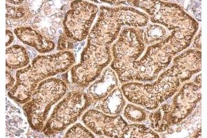 IHC-P Image VHL antibody detects VHL protein at cytosol on mouse kidney by immunohistochemical analysis. (VHL antibody)