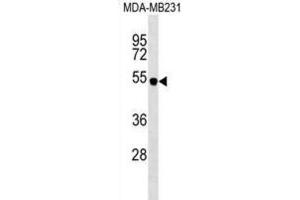 Western Blotting (WB) image for anti-Spinster Homolog 2 (SPNS2) antibody (ABIN2999753) (SPNS2 antibody)