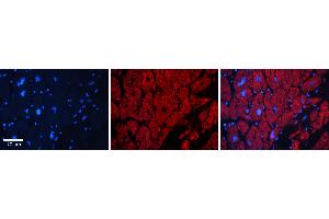 Rabbit Anti-FUBP1 Antibody   Formalin Fixed Paraffin Embedded Tissue: Human heart Tissue Observed Staining: Cytoplasmic, nucleus Primary Antibody Concentration: 1:100 Other Working Concentrations: N/A Secondary Antibody: Donkey anti-Rabbit-Cy3 Secondary Antibody Concentration: 1:200 Magnification: 20X Exposure Time: 0. (FUBP1 antibody  (N-Term))