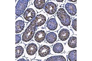 IHC analysis of SAE1 using anti-SAE1 antibody (ABIN7601346). (SAE1 antibody  (AA 33-299))