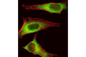Fluorescent image of Hela cell stained with TEC Antibody . (NR4A3 antibody  (AA 175-205))