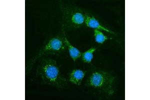 IF analysis of Alanine Transaminase/Gpt using anti-Alanine Transaminase/Gpt antibody (ABIN7600506). (ALT antibody  (AA 2-496))