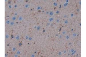 Detection of ErbB3 in Mouse Cerebrum Tissue using Polyclonal Antibody to V-Erb B2 Erythroblastic Leukemia Viral Oncogene Homolog 3 (ErbB3) (ERBB3 antibody  (AA 707-964))
