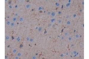 Detection of ErbB3 in Mouse Cerebrum Tissue using Polyclonal Antibody to V-Erb B2 Erythroblastic Leukemia Viral Oncogene Homolog 3 (ErbB3)