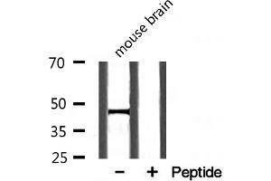 Western blot analysis on mouse brain lysate using TGF beta2 Antibody (TGFB2 antibody  (C-Term))