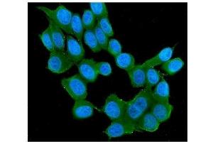 IF analysis of RAB11B using anti-RAB11B antibody (ABIN7602766). (RAB11B antibody  (C-Term))