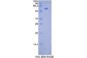 SDS-PAGE analysis of Rat NAGLU Protein. (N-Acetyl alpha-D-Glucosaminidase Protein)