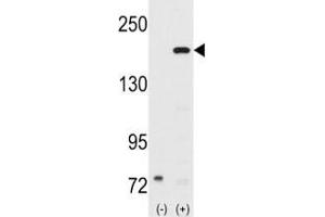 Western blot analysis of SRC-1 antibody and 293 cell lysate (2 ug/lane) either nontransfected (Lane 1) or transiently transfected with the NCOA1 gene (2). (NCOA1 antibody  (AA 186-214))