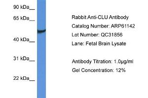 Western Blotting (WB) image for anti-Clusterin (CLU) (C-Term) antibody (ABIN2788692) (Clusterin antibody  (C-Term))