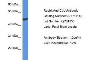 Western Blotting (WB) image for anti-Clusterin (CLU) (C-Term) antibody (ABIN786343) (Clusterin antibody  (C-Term))