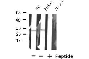Western blot analysis of extracts from Jurkat/293 cells, using KCNK7 antibody. (KCNK7 antibody)