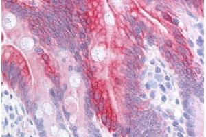 Human Small Intestine: Formalin-Fixed, Paraffin-Embedded (FFPE) (KRT20 antibody  (AA 1-425))