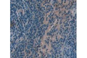Used in DAB staining on fromalin fixed paraffin- embedded Kidney tissue (HCK antibody  (AA 2-524))