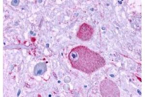 Immunohistochemistry (Formalin/PFA-fixed paraffin-embedded sections) of human brain, neurons and glia with GPR37 polyclonal antibody . (GPR37 antibody  (Extracellular Domain))