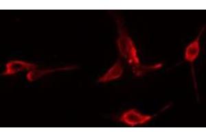 ABIN6276024 staining  Hela cells by IF/ICC. (GPRC5B antibody  (Internal Region))