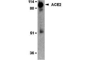 Western Blotting (WB) image for anti-Angiotensin I Converting Enzyme 2 (ACE2) (Middle Region 2) antibody (ABIN1031195) (ACE2 antibody  (Middle Region 2))