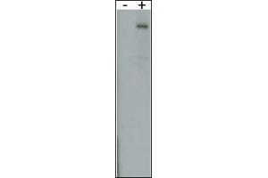 RK8 (LRRK2)Antibody  g detect over-expressed human LRRK2 protein. (LRRK2 antibody  (AA 931-962))