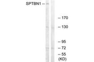 Western blot analysis of extracts from COLO cells, using SPTBN1 Antibody. (SPTBN1 antibody  (AA 651-700))