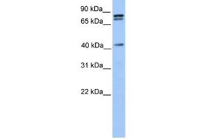 WB Suggested Anti-SUZ12 Antibody Titration:  0. (SUZ12 antibody  (C-Term))