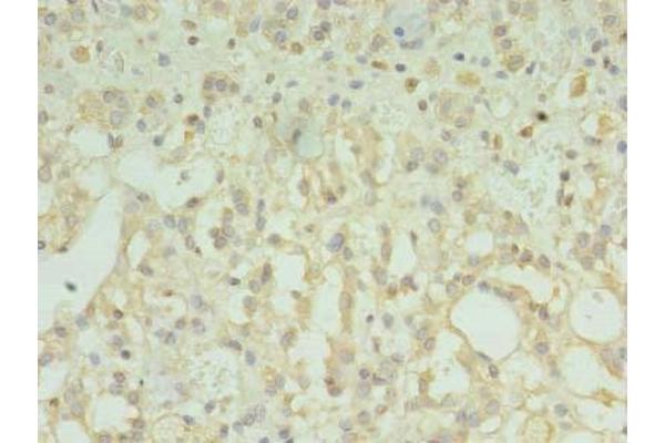 TMEM33 antibody  (AA 177-247)